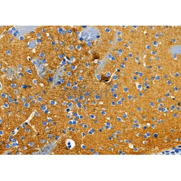OR6N1 Antibody - DF9723 at 1/100 staining Mouse brain tissue by IHC-P.