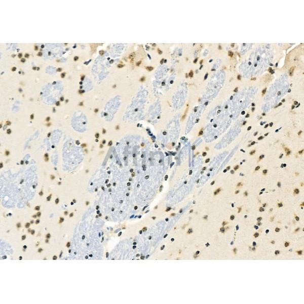 PART1 Antibody - DF9777 at 1/100 staining Mouse brain tissue by IHC-P.