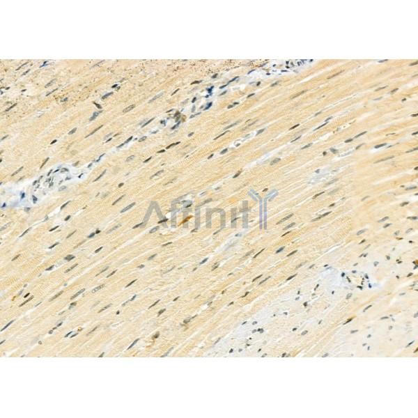 PPP1R3D Antibody - DF9780 at 1/100 staining Rat heart tissue by IHC-P.