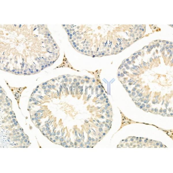 PPP1R3D Antibody - DF9780 at 1/100 staining Rat testis tissue by IHC-P.