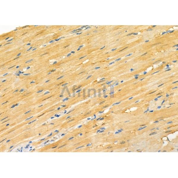 S100A7A Antibody - DF9784 at 1/100 staining Rat heart tissue by IHC-P.