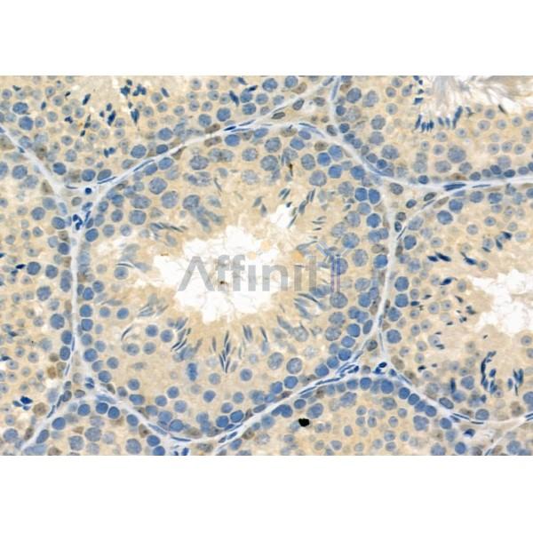 RAB11FIP5 Antibody - DF9796 at 1/100 staining Mouse testis tissue by IHC-P.