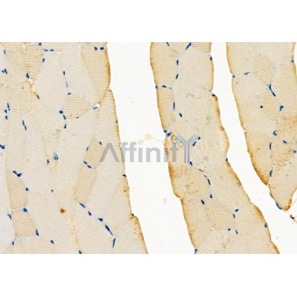 RAB11FIP5 Antibody - DF9796 at 1/100 staining Mouse muscle tissue by IHC-P.