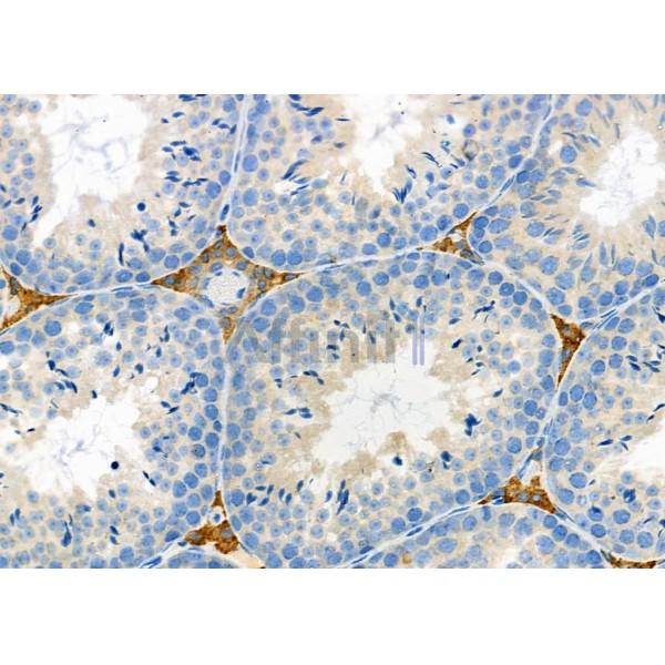 RASGEF1C Antibody - DF9809 at 1/100 staining Mouse testis tissue by IHC-P.
