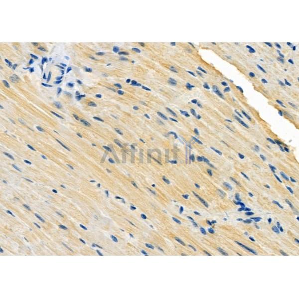 RAB28 Antibody - DF9823 at 1/100 staining Mouse heart tissue by IHC-P.