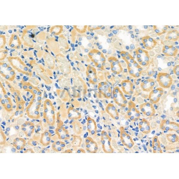 RAB32 Antibody - DF9825 at 1/100 staining Rat kidney tissue by IHC-P.