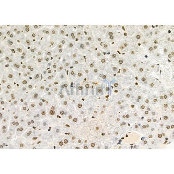 RFPL2 Antibody - DF9850 at 1/100 staining Mouse liver tissue by IHC-P.
