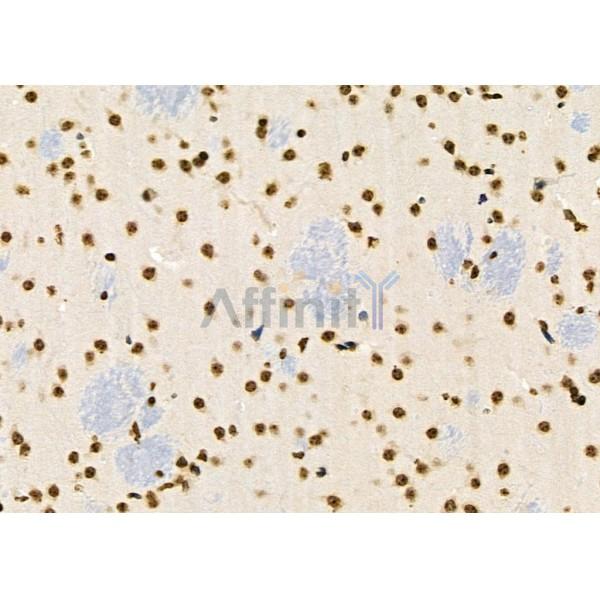 RFPL2 Antibody - DF9850 at 1/100 staining Mouse brain tissue by IHC-P.