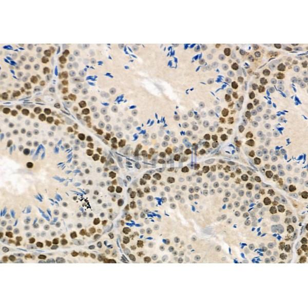 RFPL2 Antibody - DF9850 at 1/100 staining Mouse testis tissue by IHC-P.