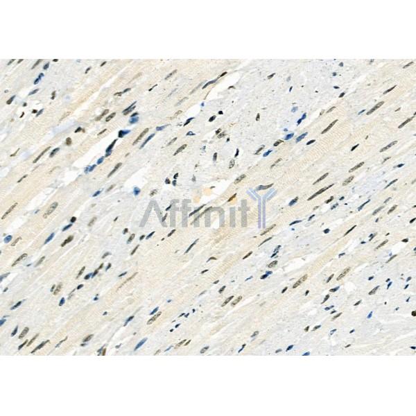 RFPL2 Antibody - DF9850 at 1/100 staining Rat heart tissue by IHC-P.