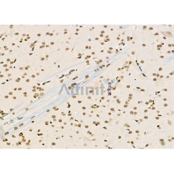 RFPL2 Antibody - DF9850 at 1/100 staining Rat brain tissue by IHC-P.