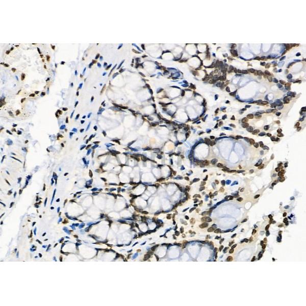 RFPL2 Antibody - DF9850 at 1/100 staining Rat stomach tissue by IHC-P.