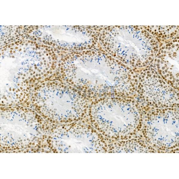 RHG23 Antibody - DF9857 at 1/100 staining Mouse testis tissue by IHC-P.