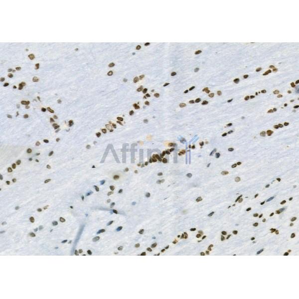 RHG23 Antibody - DF9857 at 1/100 staining Rat brain tissue by IHC-P.