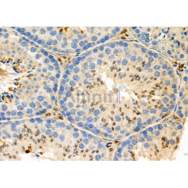 STK38L Antibody - DF9885 at 1/100 staining Mouse testis tissue by IHC-P.