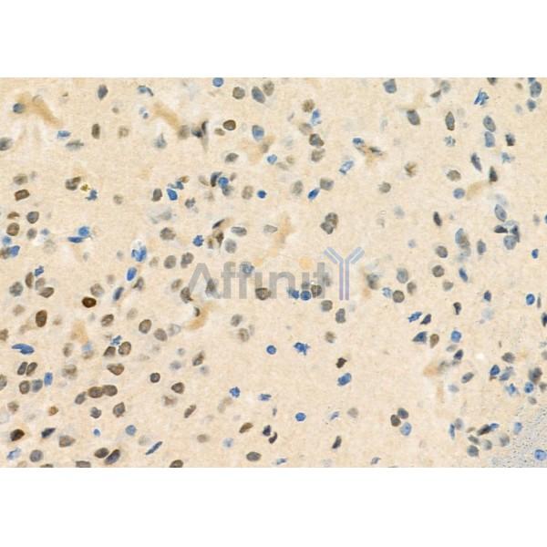 STAC3 Antibody - DF9900 at 1/100 staining Mouse brain tissue by IHC-P.