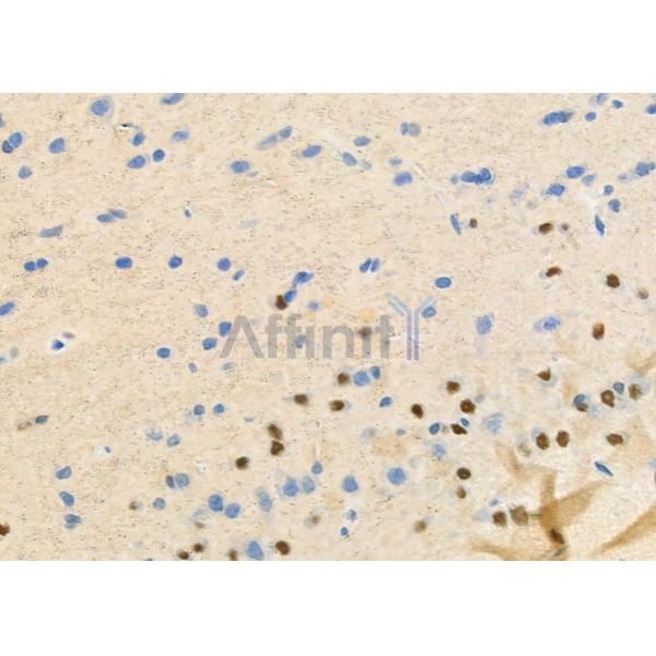 STAC3 Antibody - DF9900 at 1/100 staining Rat brain tissue by IHC-P.