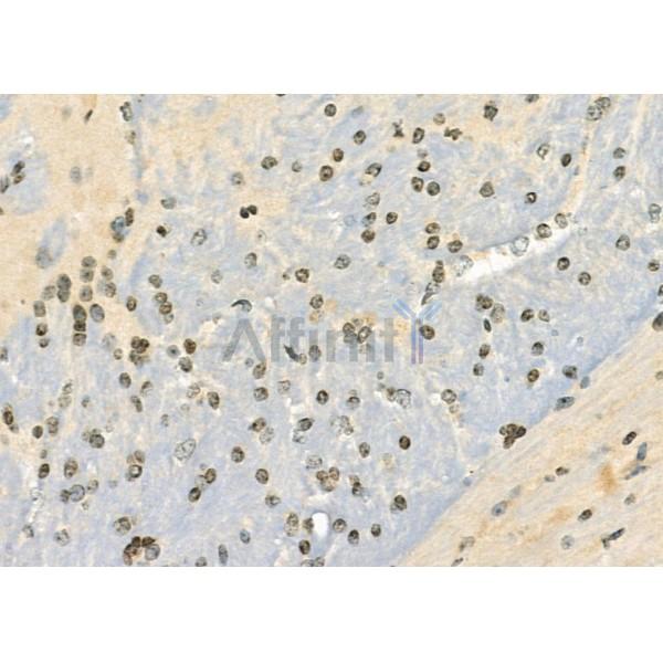 SH3BGRL2 Antibody - DF9904 at 1/100 staining Mouse brain tissue by IHC-P.