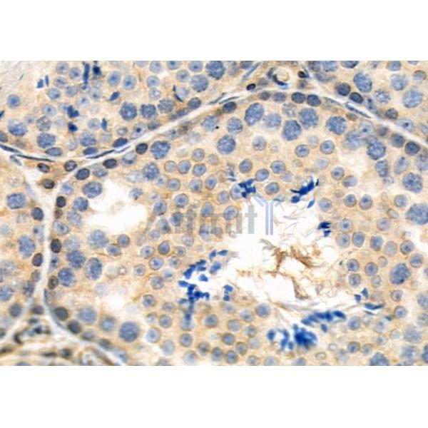 SH3GL3 Antibody - DF9907 at 1/100 staining Mouse testis tissue by IHC-P.