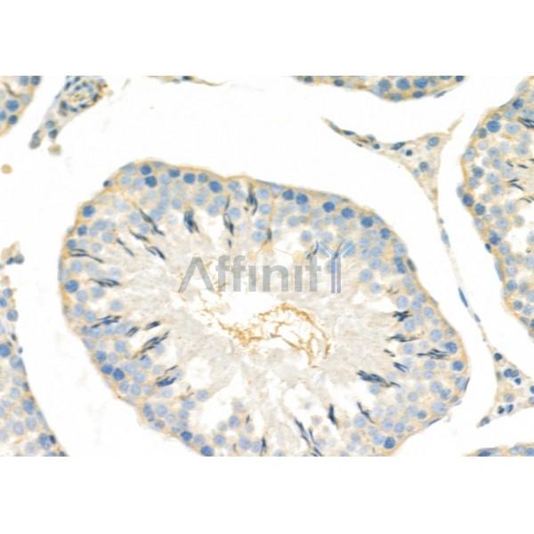 SH3GL3 Antibody - DF9907 at 1/100 staining Rat testis tissue by IHC-P.