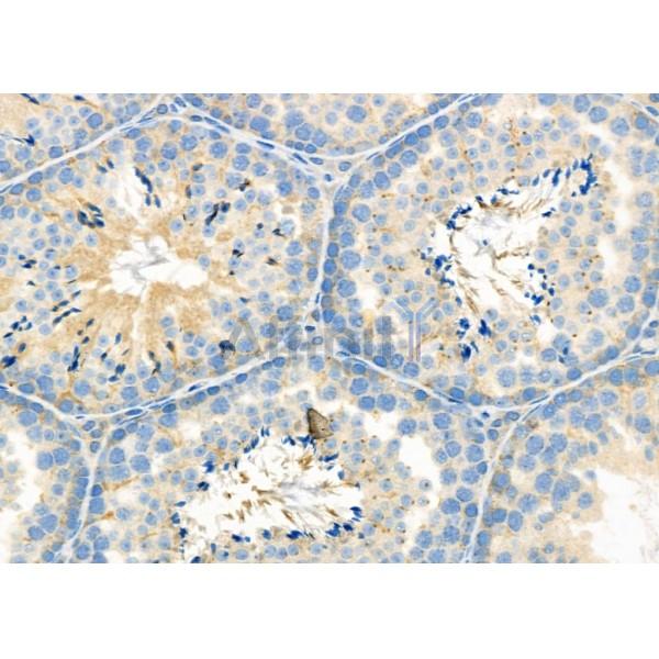 SLC9A10 Antibody - DF9934 at 1/100 staining Mouse testis tissue by IHC-P.