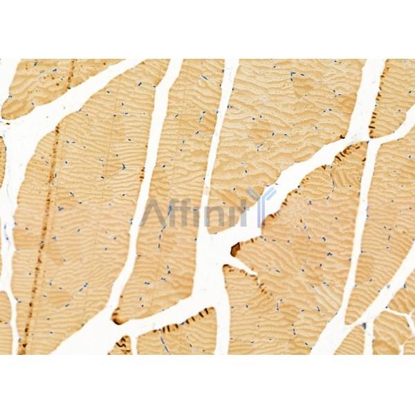 SYT10 Antibody - DF9953 at 1/100 staining Rat muscle tissue by IHC-P.