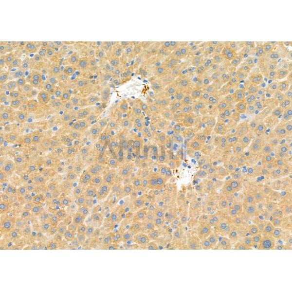 TRAPPC1 Antibody - DF9964 at 1/100 staining Mouse liver tissue by IHC-P.