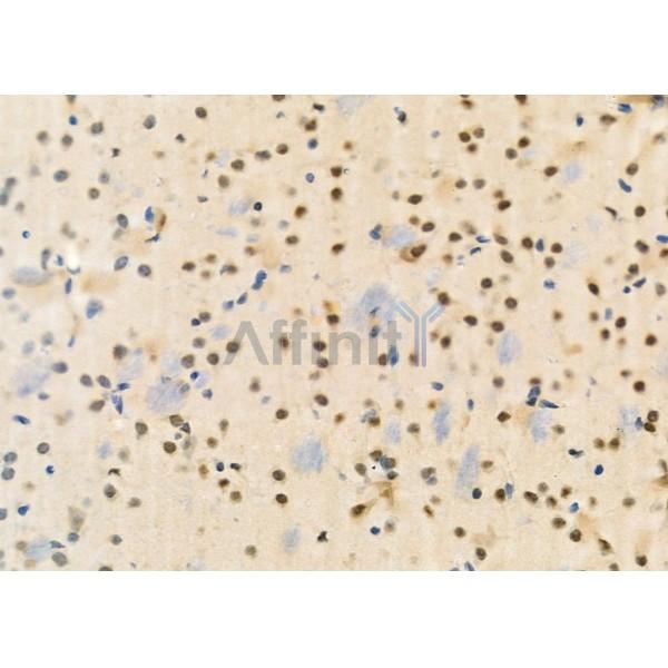 TCEAL2 Antibody - DF9967 at 1/100 staining Mouse brain tissue by IHC-P.