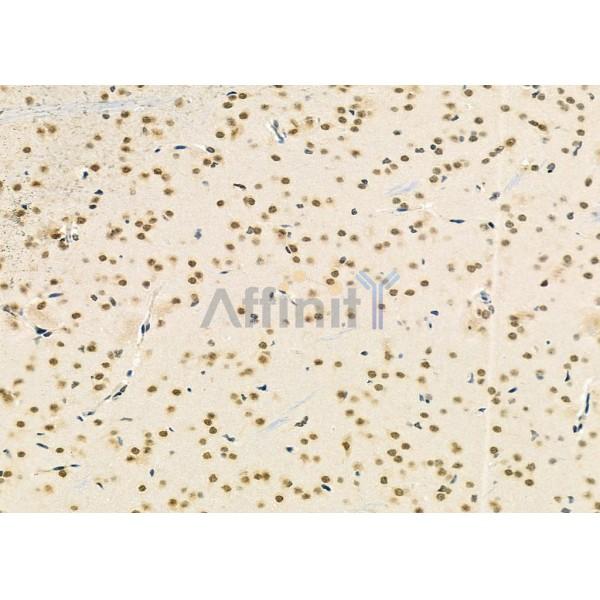 TCEAL2 Antibody - DF9967 at 1/100 staining Rat brain tissue by IHC-P.
