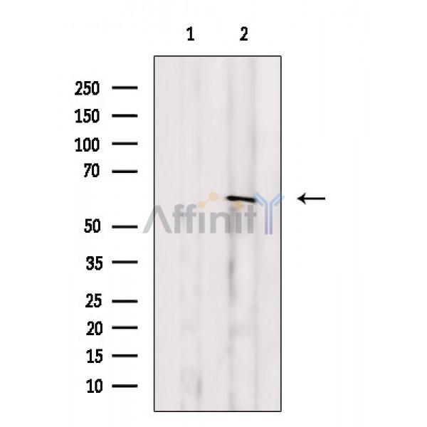 Smad4 Antibody - Western blot analysis of extracts from VERO cells(heat shock treatment), using Smad4 Antibody.