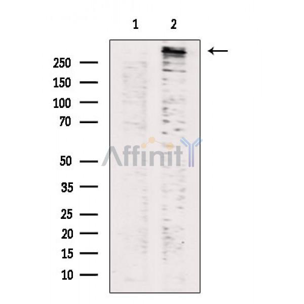 Phospho-LRRK2 (Ser935) Antibody - Western blot analysis of extracts from P19 cells(LPS treatment), using Phospho-LRRK2 (Ser935) Antibody.