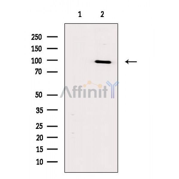 Phospho-PSD95 (Ser418) Antibody - Western blot analysis of extracts from Mouse brain, using Phospho-PSD95 (Ser418) Antibody.