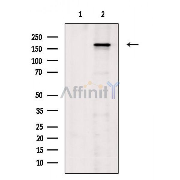 Phospho-VEGFR1 (Tyr1333) Antibody - Western blot analysis of extracts from PC12(H2O2 treatment), using Phospho-VEGFR1 (Tyr1333) Antibody.