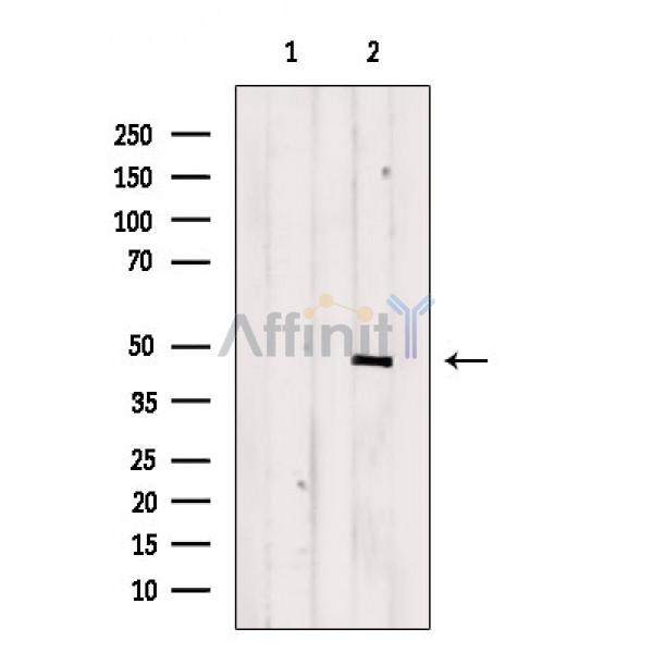 Phospho-SGK2 (Thr253) Antibody - Western blot analysis of extracts from Hela cells(serum starvation treatment), using Phospho-SGK2 (Thr253) Antibody.
