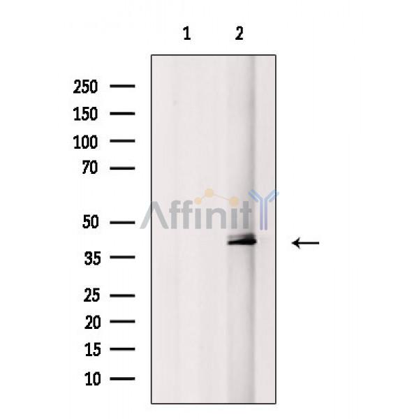 Phospho-MKK3/MKK6 (Ser189/Thr193) Antibody - Western blot analysis of extracts from Hela cells(serum starvation treatment), using Phospho-MKK3/MKK6 (Ser189/Thr193)) Antibody.