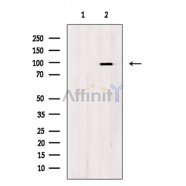 Phospho-HMGCR (Ser872) Antibody - Western blot analysis of extracts from Mouse brain, using Phospho-HMGCR (Ser872) Antibody.