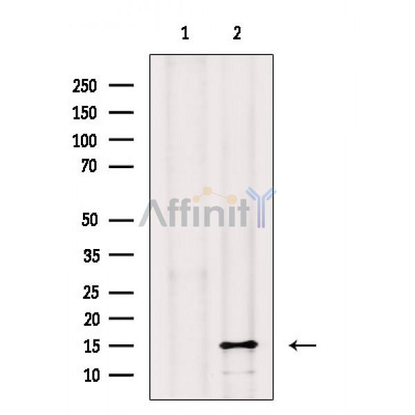 FXYD1/PLM Antibody - Western blot analysis of extracts from Mouse muscle, using FXYD1/PLM Antibody.