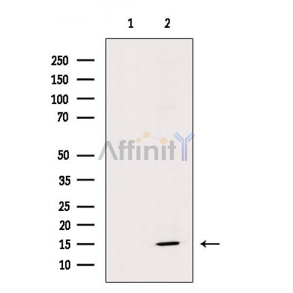 FXYD1/PLM Antibody - Western blot analysis of extracts from Mouse heart, using FXYD1/PLM Antibody.