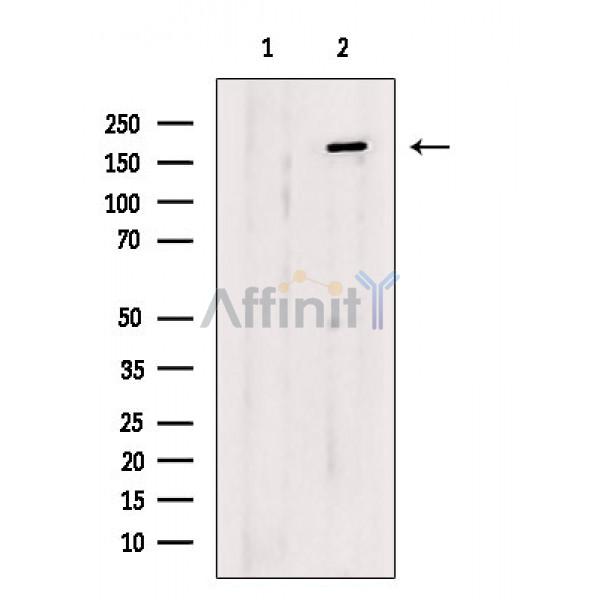 IRS1 Antibody - Western blot analysis of extracts from P19 cells(heat shock treatment), using IRS1 Antibody.