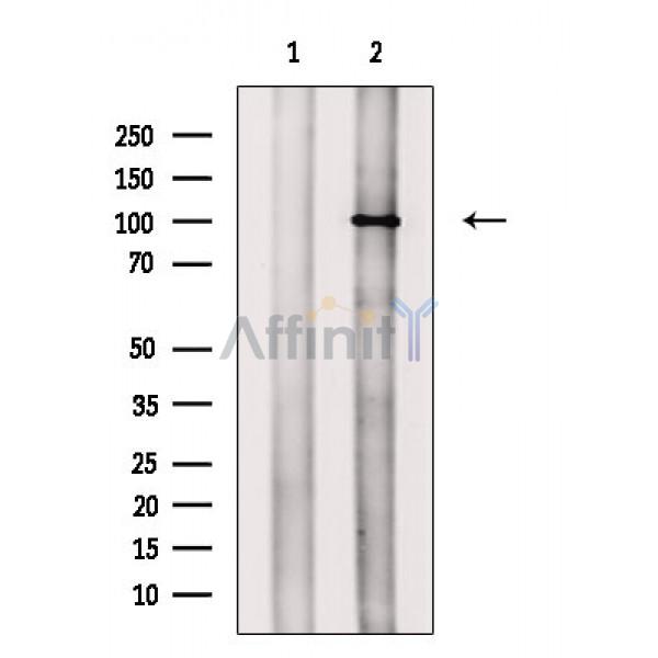 Phospho-NFAT2 (Ser294) Antibody - Western blot analysis of extracts from P19 cells(heat shock treatment), using Phospho-NFAT2 (Ser294) Antibody.