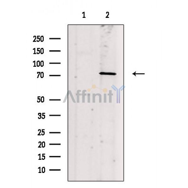Phospho-PKC beta 1 (Ser661) Antibody - Western blot analysis of extracts from P19 cells(heat shock treatment), using Phospho-PKC beta 1 (Ser661) Antibody.