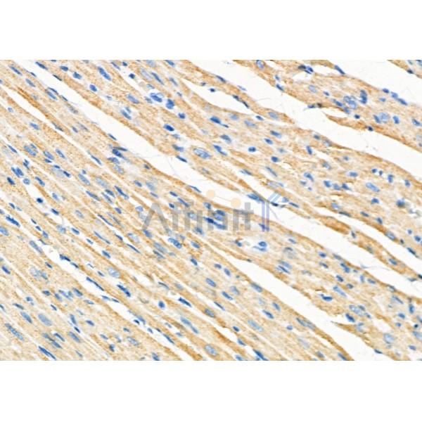 ZP2 Antibody - DF10022 at 1/100 staining Rat heart tissue by IHC-P.