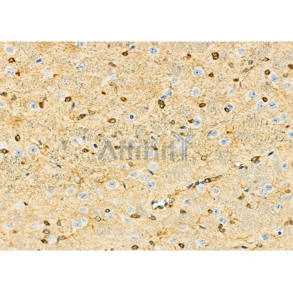 DBR1 Antibody - DF12264 at 1/100 staining Mouse brain tissue by IHC-P.