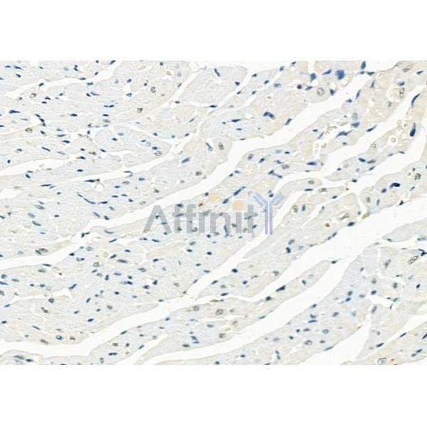 DHX9 Antibody - DF12266 at 1/100 staining Rat heart tissue by IHC-P.