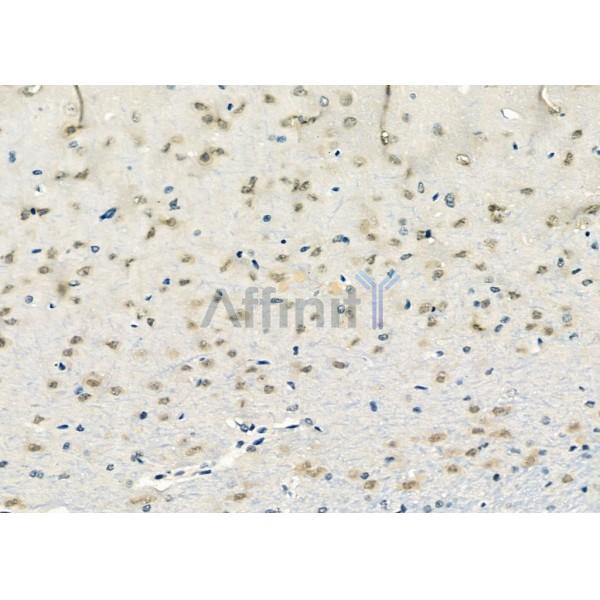 DHX9 Antibody - DF12266 at 1/100 staining Rat brain tissue by IHC-P.