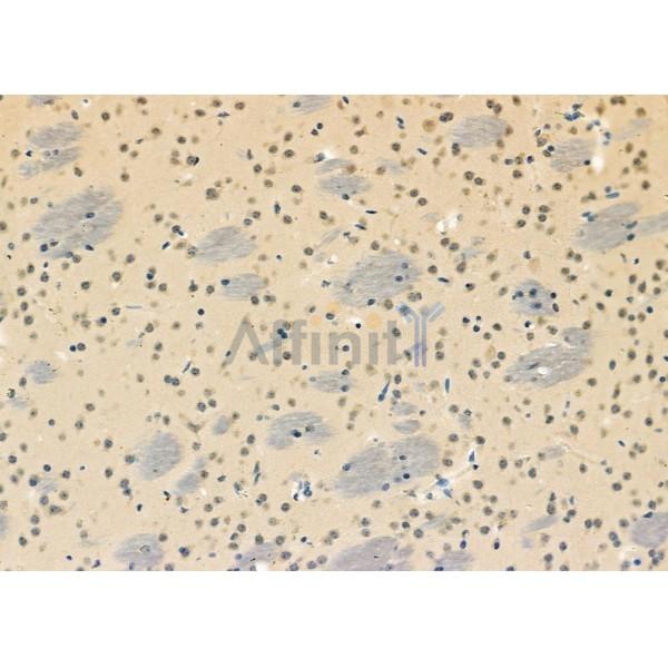 DHX9 Antibody - DF12266 at 1/100 staining Mouse brain tissue by IHC-P.