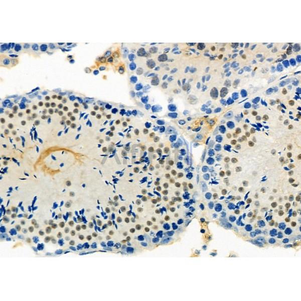 DYX1C1 Antibody - DF12270 at 1/100 staining Mouse testis tissue by IHC-P.