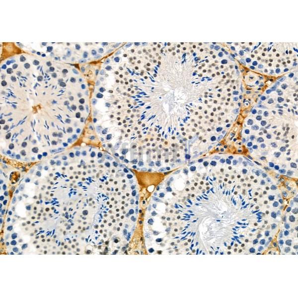DYX1C1 Antibody - DF12270 at 1/100 staining Mouse testis tissue by IHC-P.