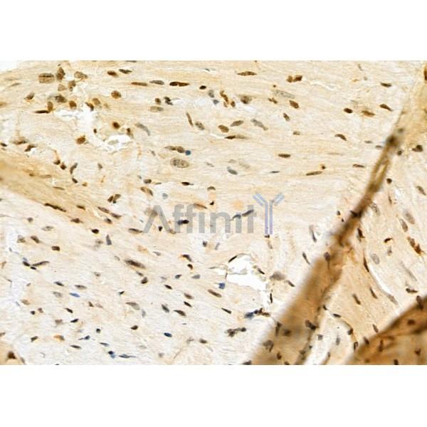 FAM96B Antibody - DF12272 at 1/100 staining Mouse heart tissue by IHC-P.