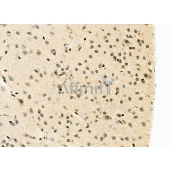 FAM96B Antibody - DF12272 at 1/100 staining Mouse brain tissue by IHC-P.